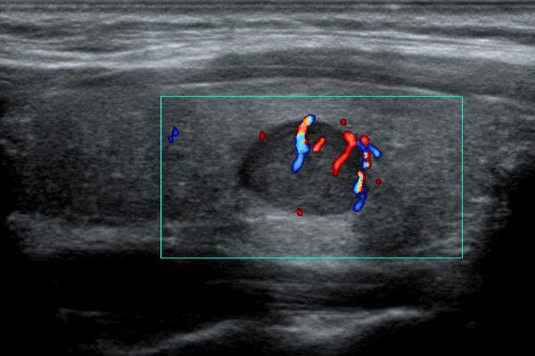 Ecografo E1 EXP Sonoscape